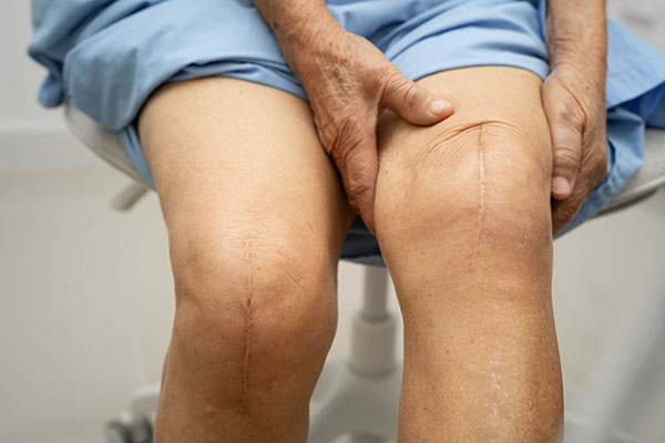 knee ouch knee ouch